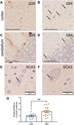 Plasma PolyQ-ATXN3 Levels Associate With Cerebellar Degeneration and Behavioral Abnormalities in a New AAV-Based SCA3 Mouse Model